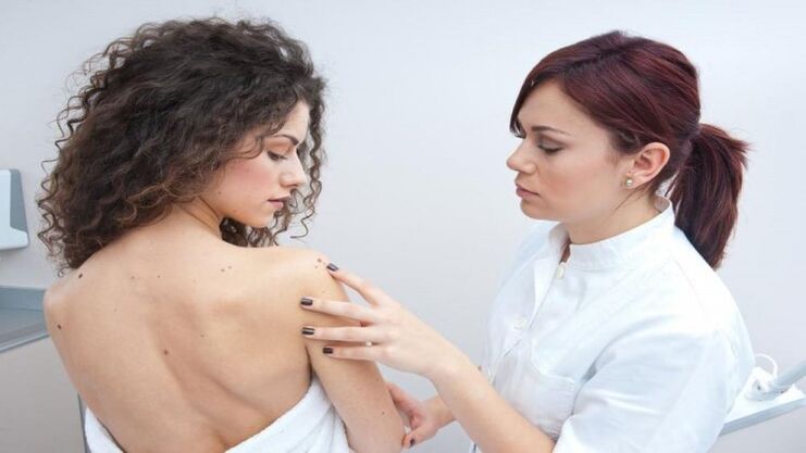a doctor examines papillomas on the skin
